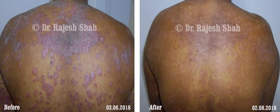 lifeforce homeopathy case-photos